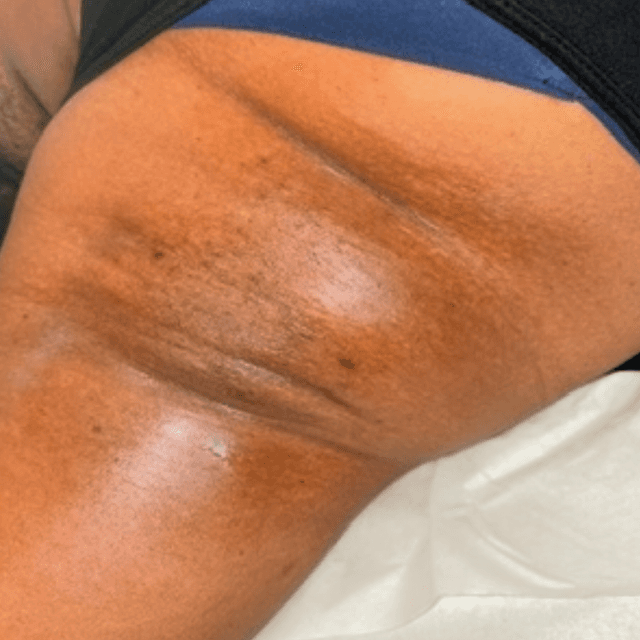 Treá Wax at Treasured Living Esthetics in Rosedale, MD